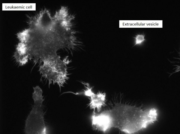 This image shows the presence of an extracellular vesicle.