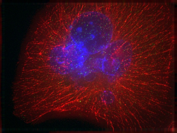 Bauchspeicheldrüsenkrebszelle: Der Zellkern (blau) und das Zytoskelett (rot)...