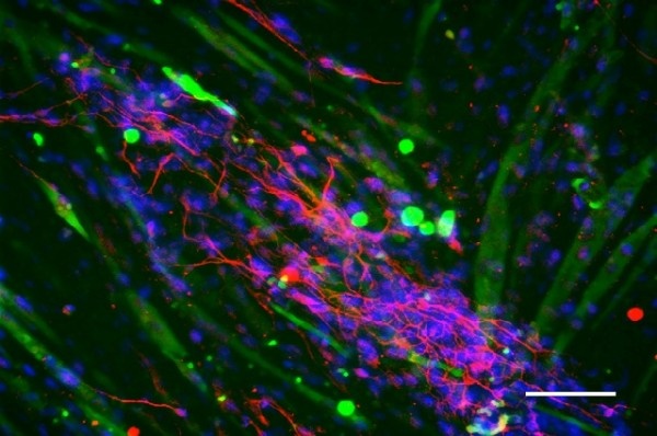 Photo: Technique generates human neural stem cells