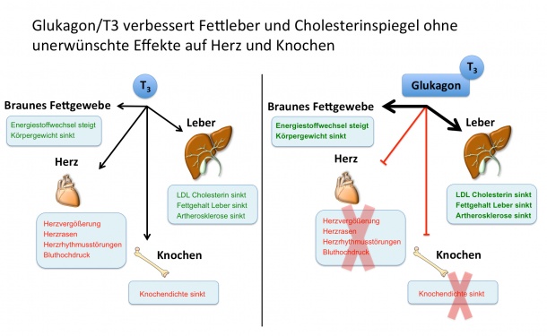 Glukagon/T3 verbessert Fettleber und Cholesterinspiegel ohne unerwünschte...