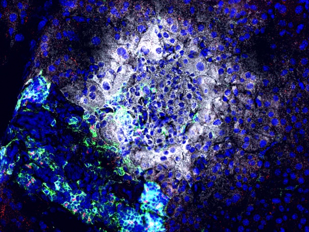 Treatment with an antagomir directed against miR92a results in reduced attacks...