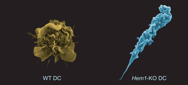 Rasterelektronenmikroskopische Aufnahmen von einer normalen dendritischen Zelle...