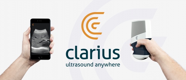 Photo: Wireless, Handheld Ultrasound For iOS and Android Debuts