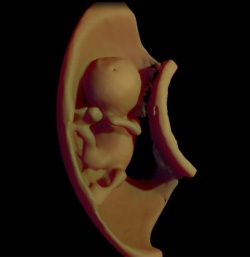 3D virtual model ultrasound view of fetus at 12 weeks.