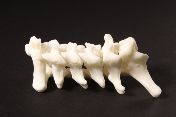 Materialise 3D Printed Spine Model.