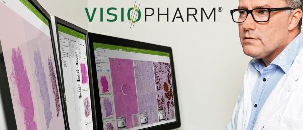 Photo: Visiopharm A/S acquires LRI Imaging AB