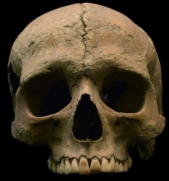 Skeletal remains of an individual from Velia, Italy. P. falciparum remains the...