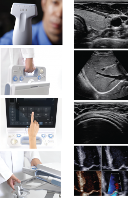 Photo: Premium Portable Ultrasound