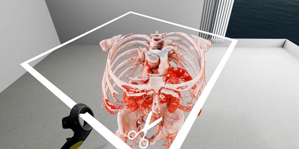 Virtual Reality: Mit SpectoVive können Ärzte in einem dreidimensionalen Raum...