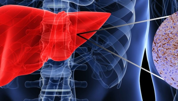 A new player in liver carcinogenesis: The inset shows cancer progenitor cells...