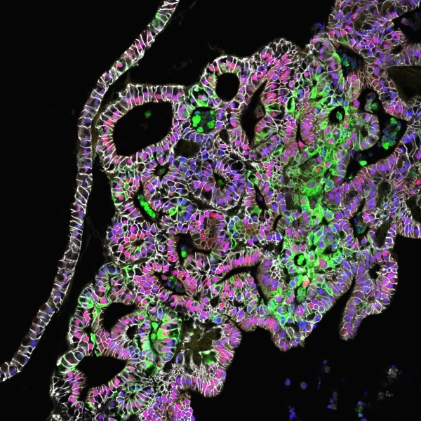 This confocal microscopic image shows tissue-engineered human stomach tissues...