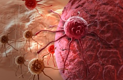 Photo: Neu entdeckte seltene Erkrankung – wie das Immunsystem die Entstehung...