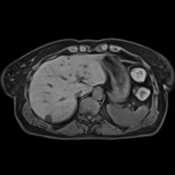 Patients with limited breath-hold capability or which are unable to follow...