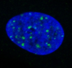 Eine durch Benzpyren geschädigte Zelle, die DNA-Brüche (grüne Punkte) im...