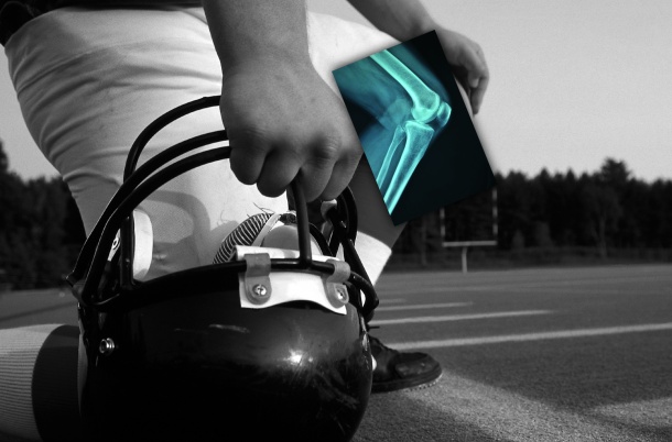 Photo: Wireless Digital X-ray Technology for Football Players at NFL Combine