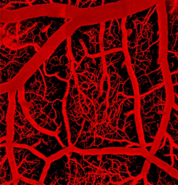 The brains vascular network, shown in this image, consists of arteries, which...