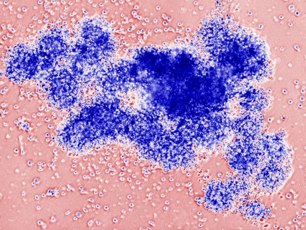 BK Polyomavirus-specific CD8-Killer-Lymphocytes (blue) in cell culture.