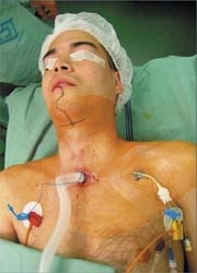 Dusan Matras, awaiting surgery. The line on his chin indicates entry area to...