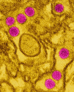 Angefärbte Elektronenmikroskopie-Aufnahme von Zika-Viren (violett) in...