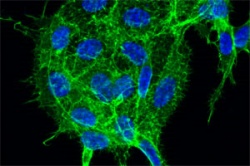 Depicted are lung cancer cells stained for the cytoskeleton (colored in green)...