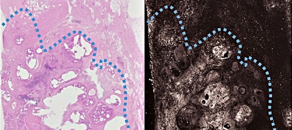 A new imaging technique based on light and sound produces images doctors can...