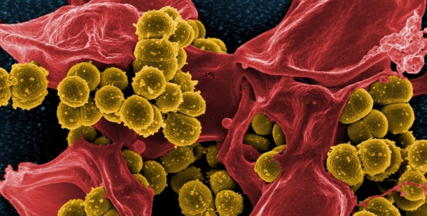 Methicillin-resistente Staphylo­coccus aureus (MRSA) (senffarben) umgeben von...