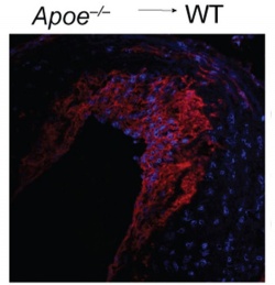 Immune cells (in red) that have just arrived at cholesterol deposits in the...