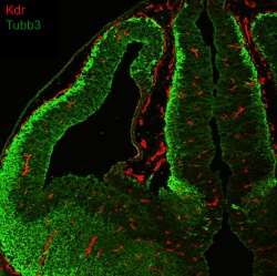 Verteilung von Endothelzellen (rot) und neuronalen Zellen (grün) im Gehirn der...