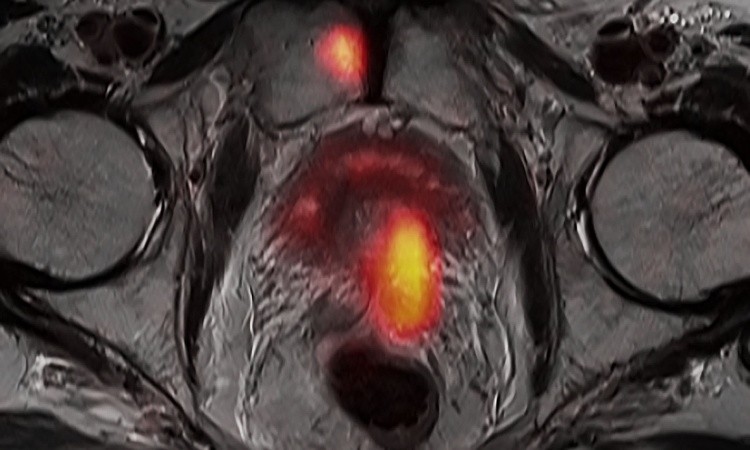 PET/MRI leads hybrid imaging • healthcare-in-europe.com