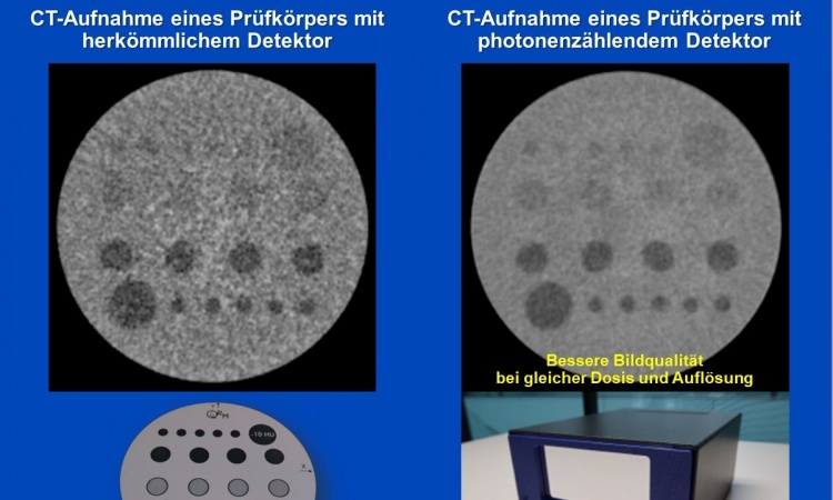 Mehr Energie für die CT