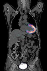 Photo: In-vivo and in-vitro diagnostics in molecular medicine