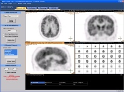 A screenshot of the interface of the Computer Aided Diagnosis system that...