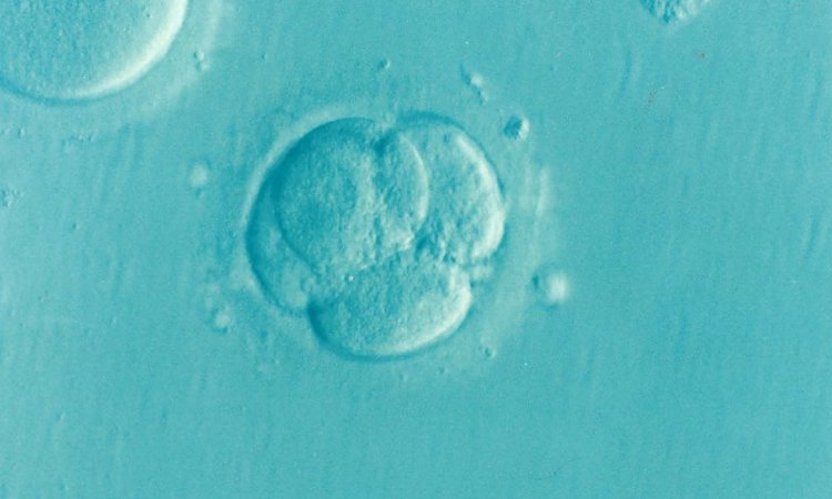 IVF: Why a single embryo sometimes leads to twins or triplets ...