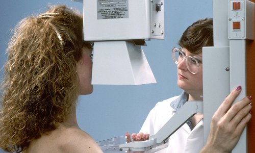 FDA advances landmark policy changes to modernize mammography services • healthcare-in-europe.com