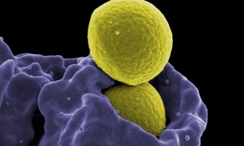 New Guidance to Stem the Tide of MRSA Spread in Hospitals