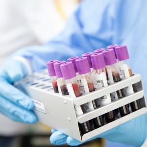 Blood Test For 50+ Types Of Cancer Promising For Screening • Healthcare ...