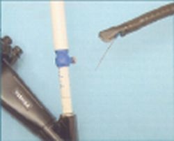 Fig.1: Toshiba PEF-708 with the Cook Echotip needle in the biopsy channel. The...
