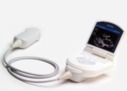The Acuson P10 portable ultrasound device.
