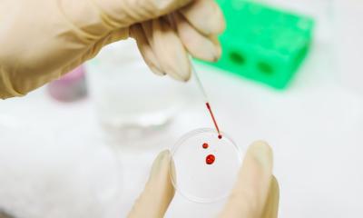 New Blood Test To Improve Prostate Cancer Screening Healthcare In New Blood Test To Improve Prostate Cancer Screening Healthcare In