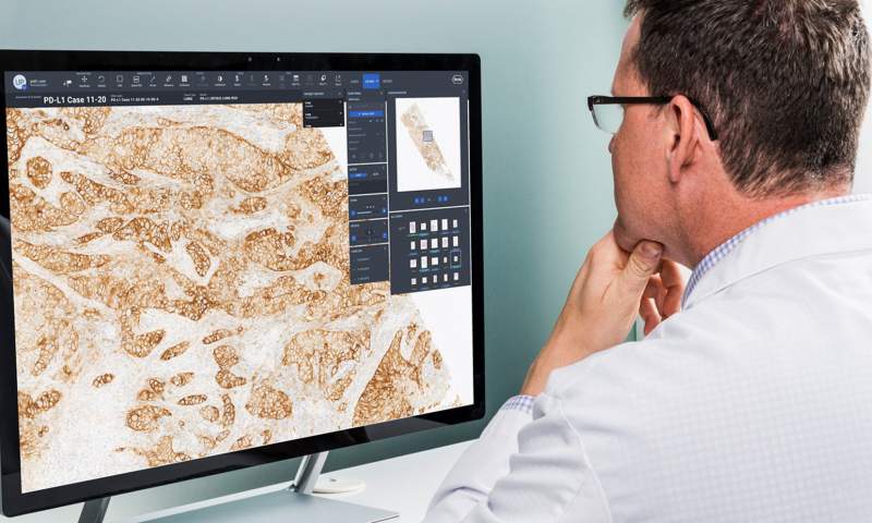 Pathology In North England Goes Digital • Healthcare-in-europe.com