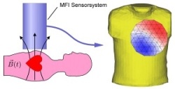 Photo: Magnetic Field Imaging improves cardiac diagnostics