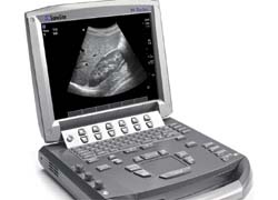 Photo: Point-of-care ultrasound from SonoSite