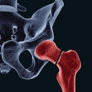 Bone cements containing antibiotics for infection prophylaxis – quo ...
