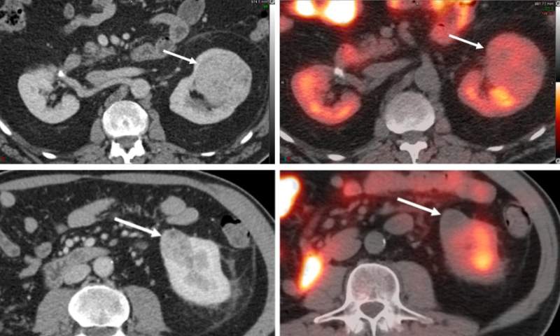 SPECT/CT • healthcare-in-europe.com