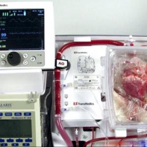 Heart in a box - First beating-heart transplantation • healthcare-in ...