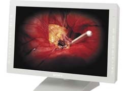 Photo: High-def surgical imaging