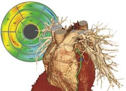 Visage CS Cardiac Analysis has integrated tools for comprehensive multi-phase...