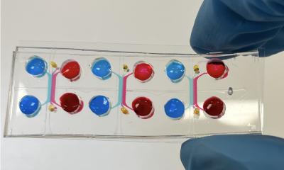 Gut-on-a-chip predicts immunotherapy efficacy against melanoma