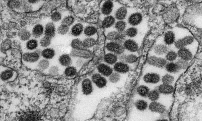 How Europe can prepare for avian flu spillover