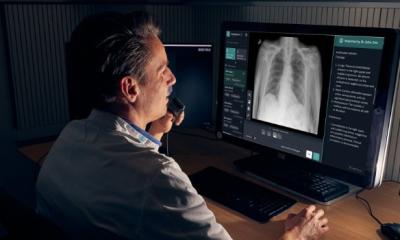 Two Dutch hospitals implement AI for lung nodule detection on chest X-rays